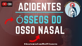 Osso Nasal ACIDENTES ÓSSEOS! Quais são❗❓DESCUBRA AQUI❗ [Anatomia Prática]