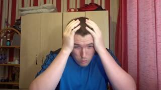 49ers vs Chiefs Reaction | Brian Hoyer Proved He's Not A Starter?