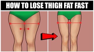 How To Lose Thigh Fat Fast | 5 Easy Exercises