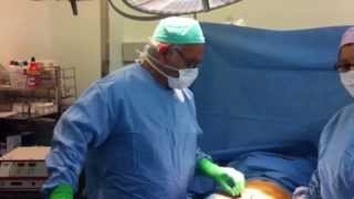 Traitement chirurgical de l'impuissance
