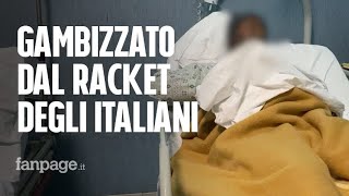 Immigrato dice no al pizzo, gambizzato in strada. "Ho denunciato, temo vendette"