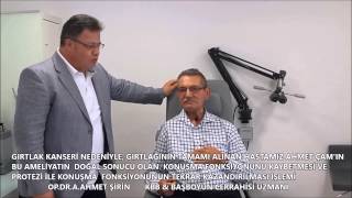 SES PROTEZİ,GIRTLAK KANSERİ AMELİYATI OLANLARDA KONUŞABİLİR