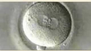 Intracytoplasmic sperm injection treatment showing high success rate in India