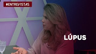 Entenda como o lúpus pode afetar a qualidade de vida de uma pessoa