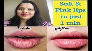 How to get soft & Pink Lips |How To Lighten Dark Lips| |Only 1 Minute|@assurehappiness