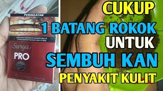 Wajib Tau !! Obat Penyakit Kulit Gatal,Eksim & Gatal Menahun~Cara Mengobati Eksim Kulit