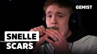 Snelle - Scars | Live bij de 538 Top 50