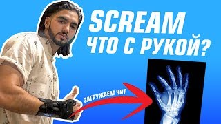 SCREAM - ЧТО С РУКОЙ? (CS:GO)