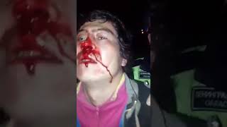 ТРУП В БАГАЖНИКЕ ДТП!!! Питер