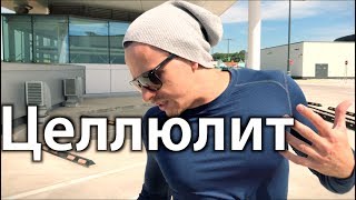 Целлюлит