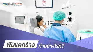 ฟันแตกร้าว ทำอย่างไรดี  | Digital Dental Center