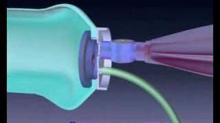 3D description of AMBU bag