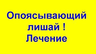 Опоясывающий лишай. Герпес . Он заразен? Лечение народными средствами