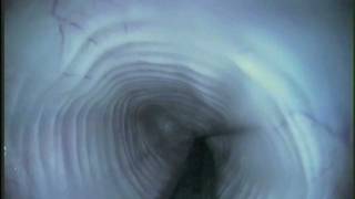 Needle in stomach from a cat , www.endovet.ru