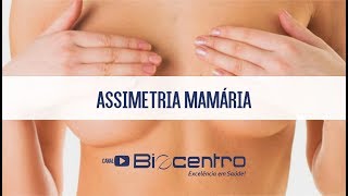 Assimetria mamária: veja o que fazer quando os seios são diferentes