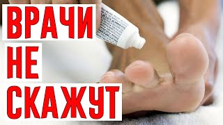 Kaк Быcmpo Избaвumьcя om Гpuбкa Сmoпы! Paбomaem 100%!