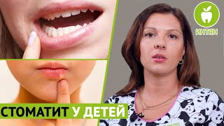 Как лечить стоматит у детей? Лечение стоматита у детей. Интан