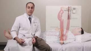 Iliotibial Band Syndrome Physical Exam - Stanford Medicine 25