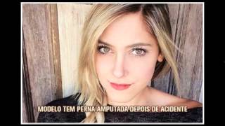 Jovem atingida por carro na Raja Gabáglia tem perna amputada