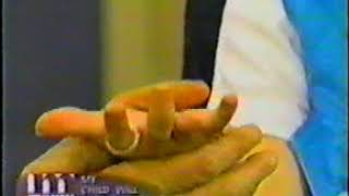 Amputated ring finger. Ring finger amputee woman. Finger stump. Nicole. Maury show