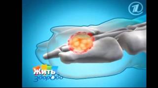 Вросший ноготь и его лечение