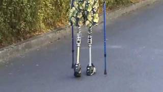 MED UPDATE Dbl AK amputee without Prosthetic socket using the Eska Endo-Exo for better quality life
