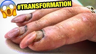 DESTROYED NAILS #TRANSFORMATION | HARD WORKER WOMAN GETS CRAZY #RUSSIAN STYLE MANICURE at home