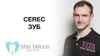 #Стоматолог Стас Белоус #КОРОНКА НА #CEREC ЗУБ 47