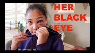 HER BLACK EYE