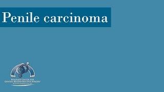 Penile Carcinoma: Complete Penile Reconstruction