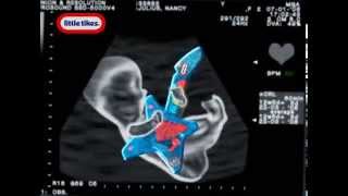 Little Tikes Музыкальные инструменты   YouTube