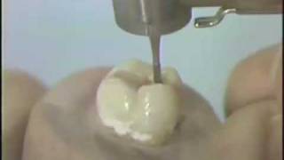 Introduction to Hand and Rotary Cutting Instruments