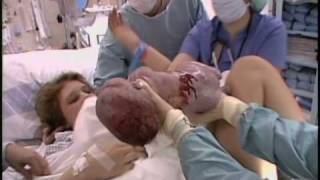 Breastfeeding: Episode 9 of 16