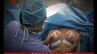 Augmentation mammaire et chirurgie esthétique