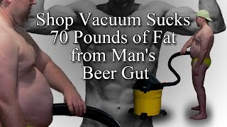 Shop Vacuum Sucks 70 Pounds of Fat from Man's Beer Gut