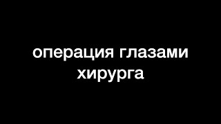 prostatectomy full time // операция на GoPro // глазами хирурга