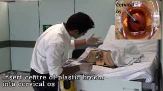 Speculum exam and cervical smear