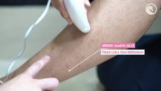 How to use Smart Hair Removal Machine Candy - Myhairstore
