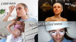 extreme £1000 transformation but I look worse after :/ and I oop