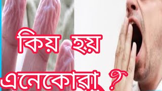 Sad, Hiccups, yawn in assamese|| Did you know about that?  Fact about human body with their causes