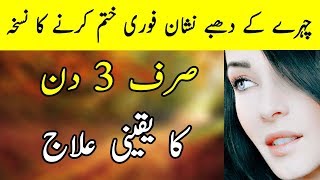 Face Spot Removal - Kale Daag Hatane Ki Tips