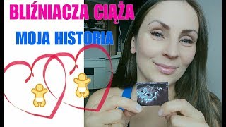 BLIŹNIACZA CIĄŻA | MOJA HISTORIA