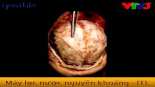 THỰC TRẠNG Ô NHIỄM NGUỒN NƯỚC - HÃY TỰ CỨU MÌNH
