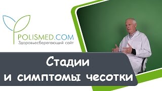Стадии и симптомы чесотки: высыпания, зуд, температура. Запущенная чесотка