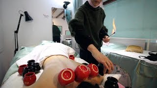 Chinese FIRE CUPPING Therapy