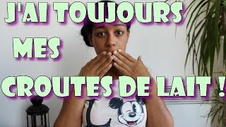 #34-Ma dermatite séborrhéique! CONSEIL+EXPERIENCE ?