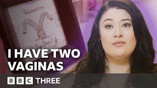 The Woman With Two Vaginas | Living Differently