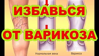 Вариоль Инструкция По Применению