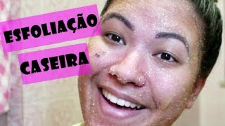 ESFOLIAÇÃO CASEIRA COM AÇÚCAR