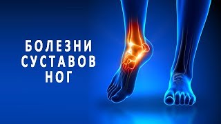 Симптомы и лечение болезней суставов ног